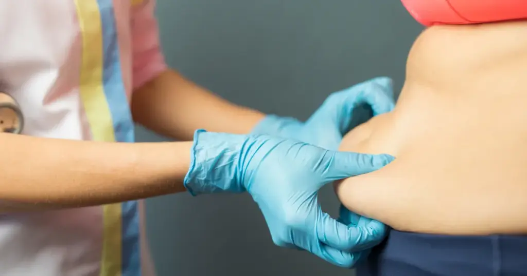 A medical professional examines abdominal fat on a patient to assess Shrink Fat in Highland, MD, and treatment options.